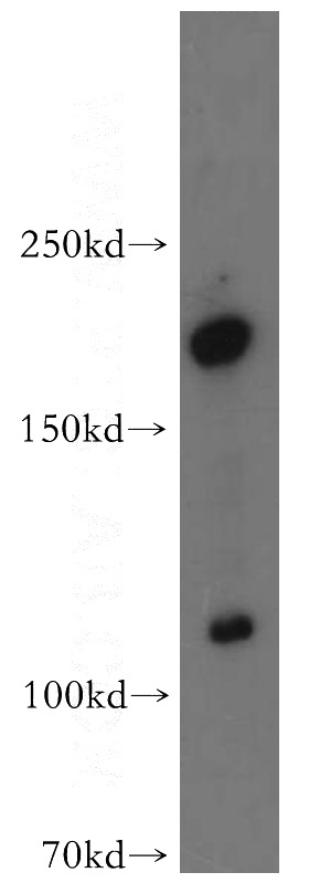 Y79 cells were subjected to SDS PAGE followed by western blot with Catalog No:107779(ADCY1 antibody) at dilution of 1:500