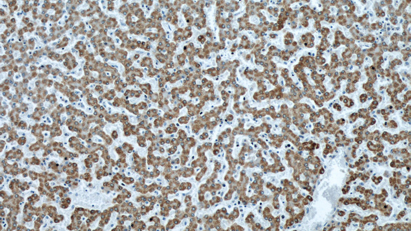 Immunohistochemical of paraffin-embedded human liver using Catalog No:107065(APOL1 antibody) at dilution of 1:500 (under 10x lens)
