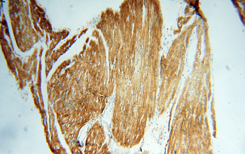 Immunohistochemical of paraffin-embedded human heart using Catalog No:108910(CASQ2 antibody) at dilution of 1:100 (under 10x lens)