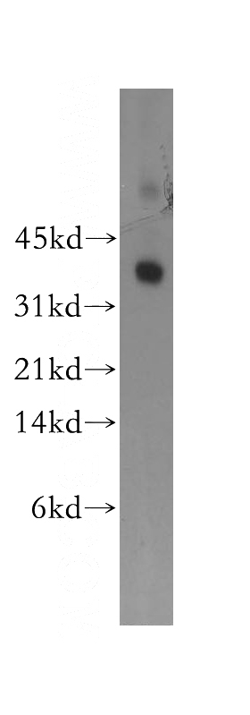 human placenta tissue were subjected to SDS PAGE followed by western blot with Catalog No:115791(STX11 antibody) at dilution of 1:400