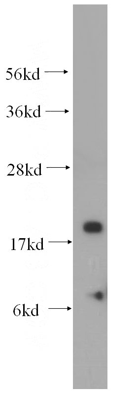 human heart tissue were subjected to SDS PAGE followed by western blot with Catalog No:113064(NDUFA8 antibody) at dilution of 1:500