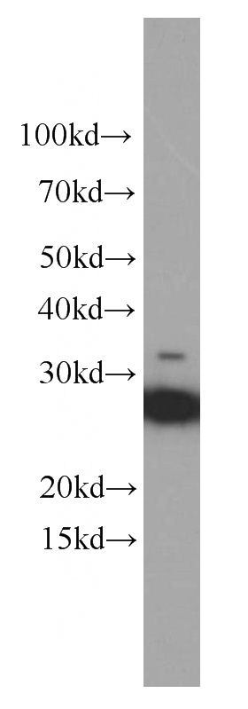 fetal human brain tissue were subjected to SDS PAGE followed by western blot with Catalog No:107597(SNAP Antibody) at dilution of 1:2000