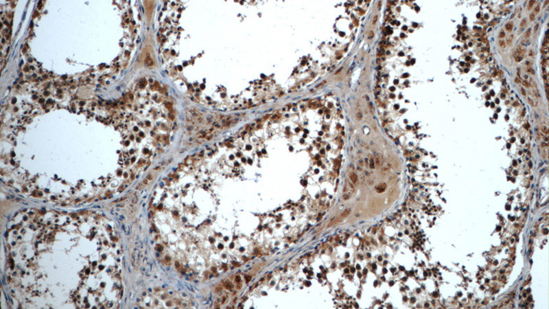 Immunohistochemistry of paraffin-embedded human testis tissue slide using Catalog No:115973(TADA1L Antibody) at dilution of 1:50 (under 10x lens)