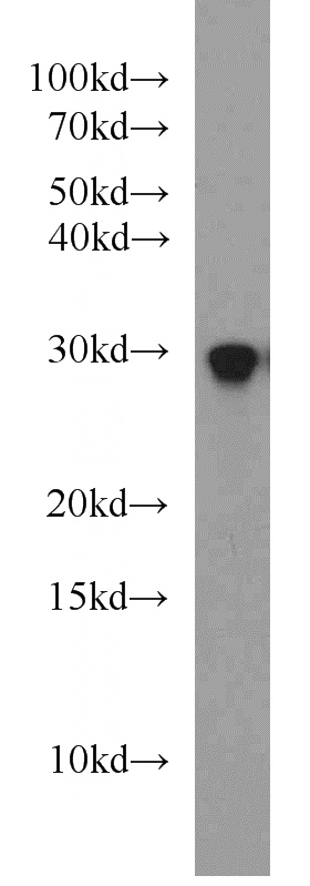 mouse skin tissue were subjected to SDS PAGE followed by western blot with Catalog No:114462(RAB8B antibody) at dilution of 1:1000