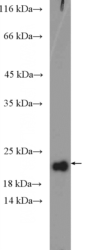 COLO 320 cells were subjected to SDS PAGE followed by western blot with Catalog No:114821(RPP21 Antibody) at dilution of 1:600