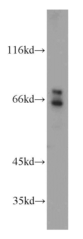 HEK-293 cells were subjected to SDS PAGE followed by western blot with Catalog No:117081(AXUD1 antibody) at dilution of 1:500