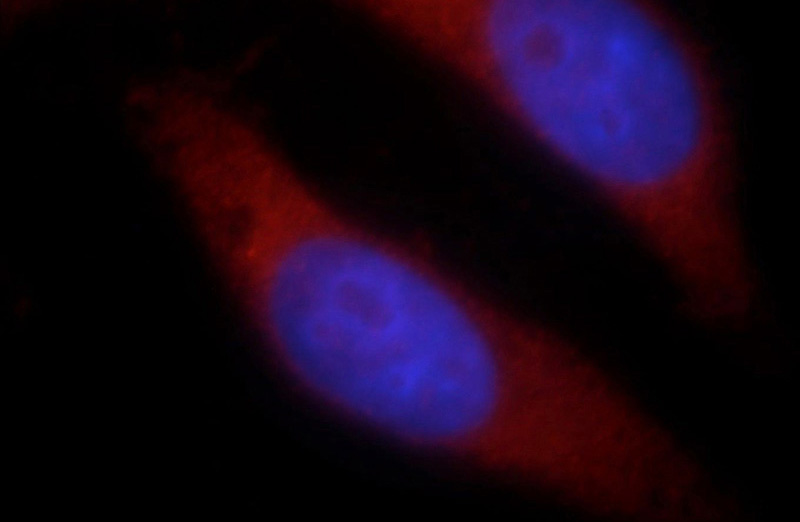 Immunofluorescent analysis of HepG2 cells, using LARS antibody Catalog No:112149 at 1:25 dilution and Rhodamine-labeled goat anti-rabbit IgG (red). Blue pseudocolor = DAPI (fluorescent DNA dye).