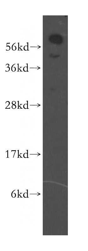 HeLa cells were subjected to SDS PAGE followed by western blot with Catalog No:116170(TOM1L1 antibody) at dilution of 1:500