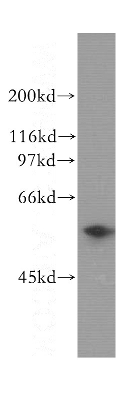 MCF7 cells were subjected to SDS PAGE followed by western blot with Catalog No:110325(ENPP5 antibody) at dilution of 1:300