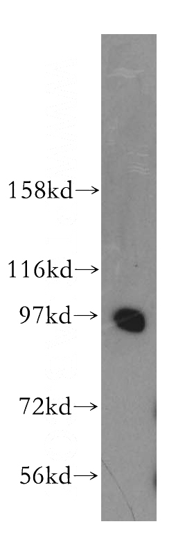 human brain tissue were subjected to SDS PAGE followed by western blot with Catalog No:114201(PRKD2 antibody) at dilution of 1:500