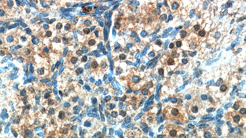 Immunohistochemical of paraffin-embedded human ovary using Catalog No:116861(WDR24 antibody) at dilution of 1:50 (under 40x lens)