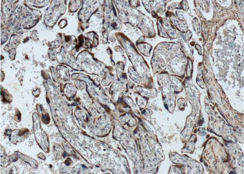 Immunohistochemistry of paraffin-embedded human placenta tissue slide using Catalog No:116074(TLR4 Antibody) at dilution of 1:200 (under 10x lens).