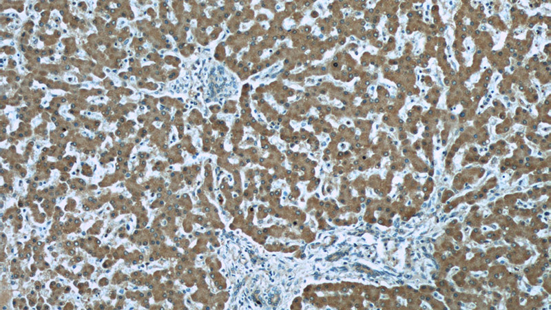 Immunohistochemistry of paraffin-embedded human liver tissue slide using Catalog No:107624(TIMM44 Antibody) at dilution of 1:50