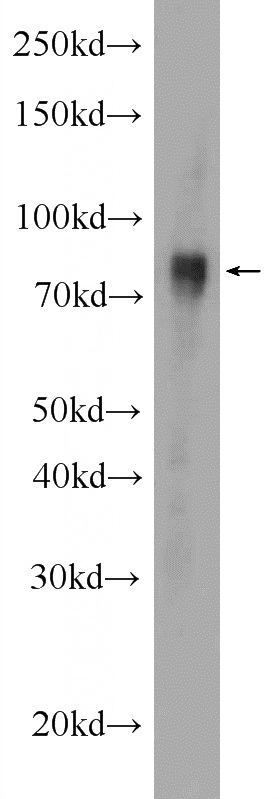 HEK-293 cells were subjected to SDS PAGE followed by western blot with Catalog No:110962(GGT7 Antibody) at dilution of 1:1000