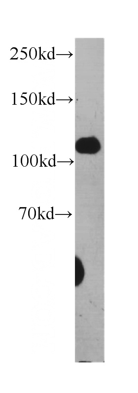 HEK-293 cells were subjected to SDS PAGE followed by western blot with Catalog No:107240(DSC2 antibody) at dilution of 1:1000