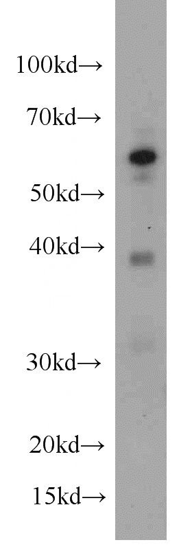 HeLa cells were subjected to SDS PAGE followed by western blot with Catalog No:107453(PAX4 antibody) at dilution of 1:500