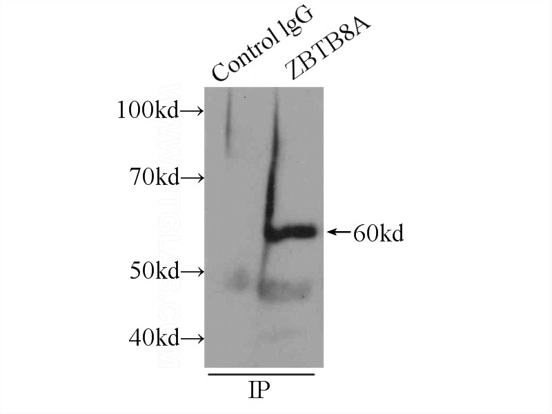 IP Result of anti-ZBTB8A (IP:Catalog No:116921, 3ug; Detection:Catalog No:116921 1:300) with HEK-293 cells lysate 920ug.