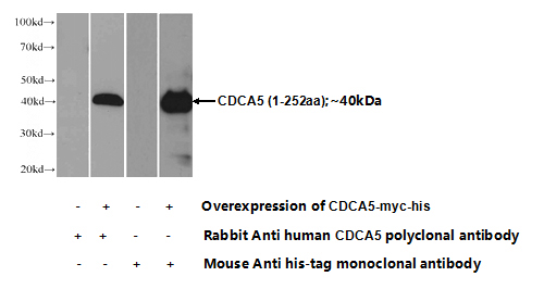 Transfected HEK-293 cells were subjected to SDS PAGE followed by western blot with Catalog No:109116(CDCA5 Antibody) at dilution of 1:1000