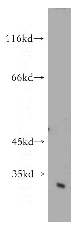 human brain tissue were subjected to SDS PAGE followed by western blot with Catalog No:108889(CTSD antibody) at dilution of 1:500