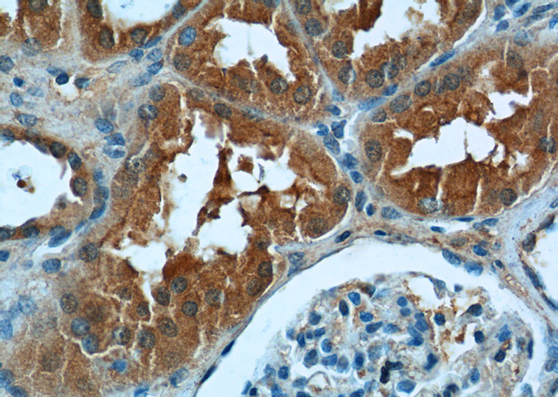 Immunohistochemistry of paraffin-embedded human kidney tissue slide using Catalog No:110081(DNAH17 Antibody) at dilution of 1:50 (under 40x lens)