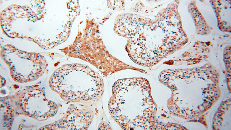 Immunohistochemical of paraffin-embedded human testis using Catalog No:110180(EIF2AK2 antibody) at dilution of 1:100 (under 10x lens)