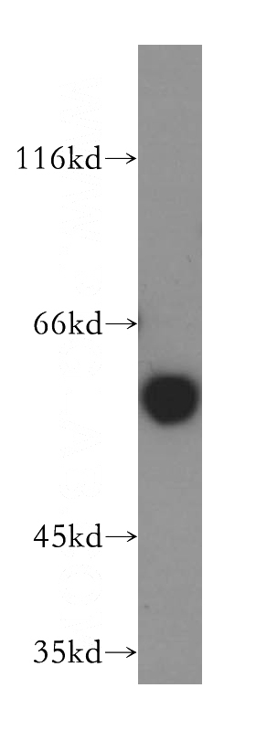 mouse liver tissue were subjected to SDS PAGE followed by western blot with Catalog No:109222(CHDH antibody) at dilution of 1:800