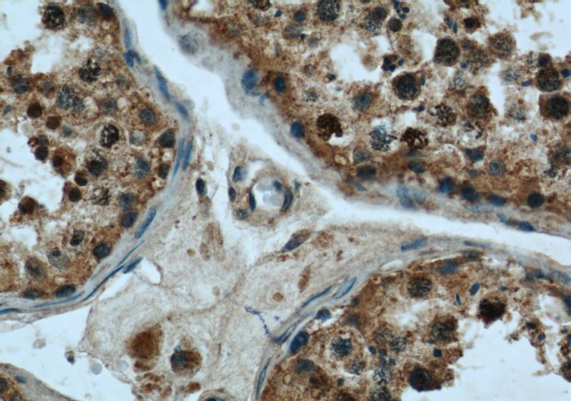 Immunohistochemical of paraffin-embedded human testis using Catalog No:116626(UPF3A antibody) at dilution of 1:50 (under 40x lens)
