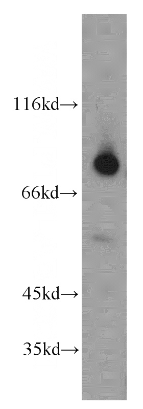 Y79 cells were subjected to SDS PAGE followed by western blot with Catalog No:108835(CAPN2 antibody) at dilution of 1:200