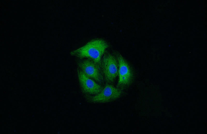 Immunofluorescent analysis of SH-SY5Y cells using Catalog No:112472(MAP1B Antibody) at dilution of 1:25 and Alexa Fluor 488-congugated AffiniPure Goat Anti-Rabbit IgG(H+L)