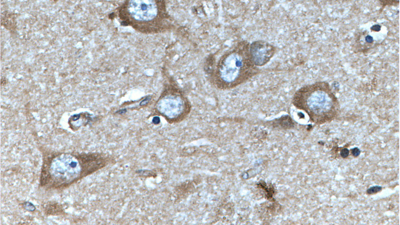 Immunohistochemistry of paraffin-embedded human brain tissue slide using Catalog No:108758(CACNA1D Antibody) at dilution of 1:50 (under 40x lens)