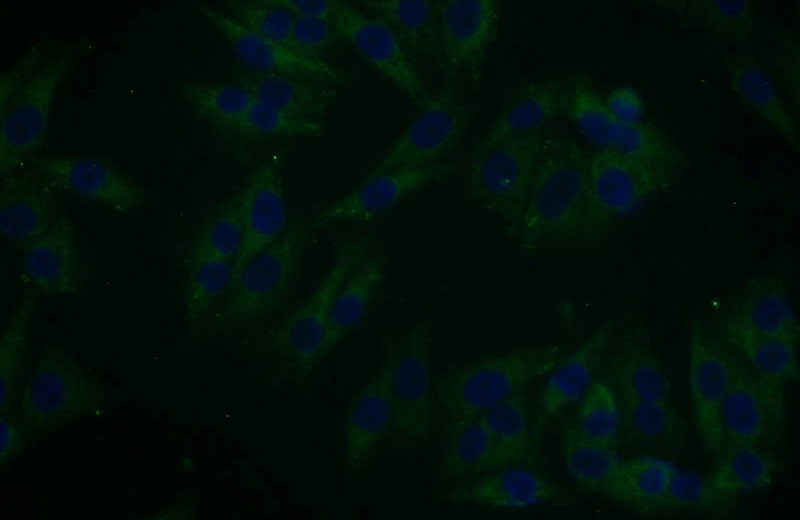 Immunofluorescent analysis of A375 cells using Catalog No:115168(SGK3 Antibody) at dilution of 1:25 and Alexa Fluor 488-congugated AffiniPure Goat Anti-Rabbit IgG(H+L)