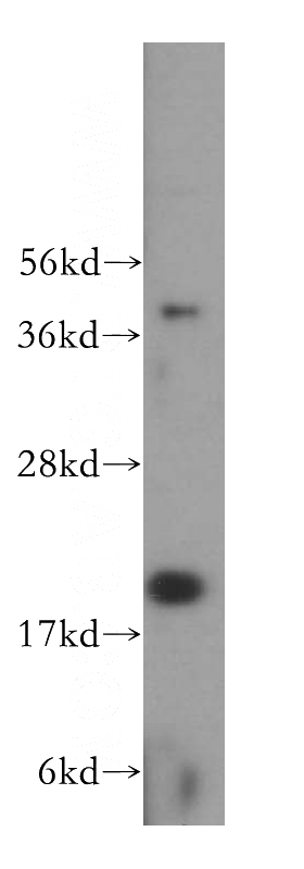 mouse testis tissue were subjected to SDS PAGE followed by western blot with Catalog No:109261(CETN3 antibody) at dilution of 1:300