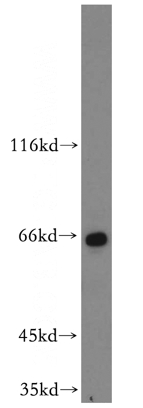 HeLa cells were subjected to SDS PAGE followed by western blot with Catalog No:117163(ZNF34 antibody) at dilution of 1:500