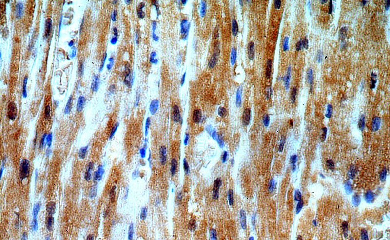 Immunohistochemical of paraffin-embedded human heart using Catalog No:116471(UBAC1 antibody) at dilution of 1:100 (under 40x lens)