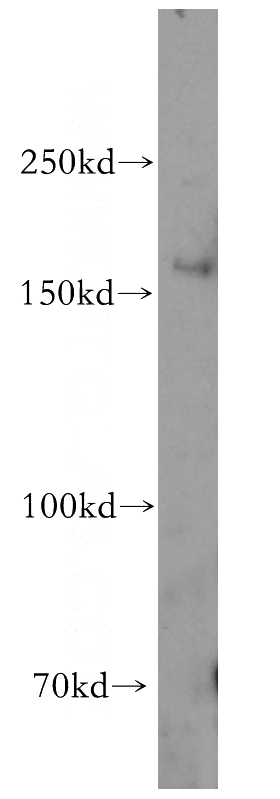 HeLa cells were subjected to SDS PAGE followed by western blot with Catalog No:111461(HRC antibody) at dilution of 1:500