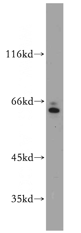 HepG2 cells were subjected to SDS PAGE followed by western blot with Catalog No:115193(SERINC2-Specific antibody) at dilution of 1:100