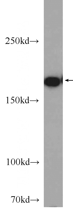 mouse skeletal muscle tissue were subjected to SDS PAGE followed by western blot with Catalog No:112993(MYOM1-Specific antibody) at dilution of 1:600