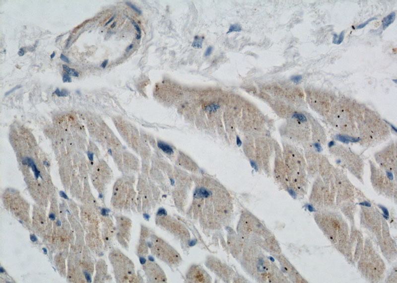 Immunohistochemical of paraffin-embedded human heart using Catalog No:115683(ABRA antibody) at dilution of 1:50 (under 40x lens)