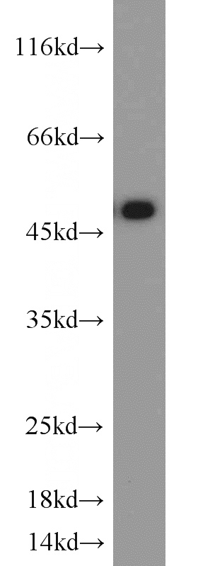 HEK-293 cells were subjected to SDS PAGE followed by western blot with Catalog No:110482(ETF1 antibody) at dilution of 1:800