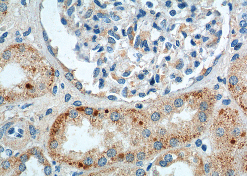 Immunohistochemistry of paraffin-embedded human kidney tissue slide using Catalog No:107834(AGPAT9 Antibody) at dilution of 1:200 (under 40x lens).