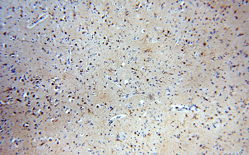 Immunohistochemical of paraffin-embedded human brain using Catalog No:108919(CAMK2D-Specific antibody) at dilution of 1:100 (under 10x lens)
