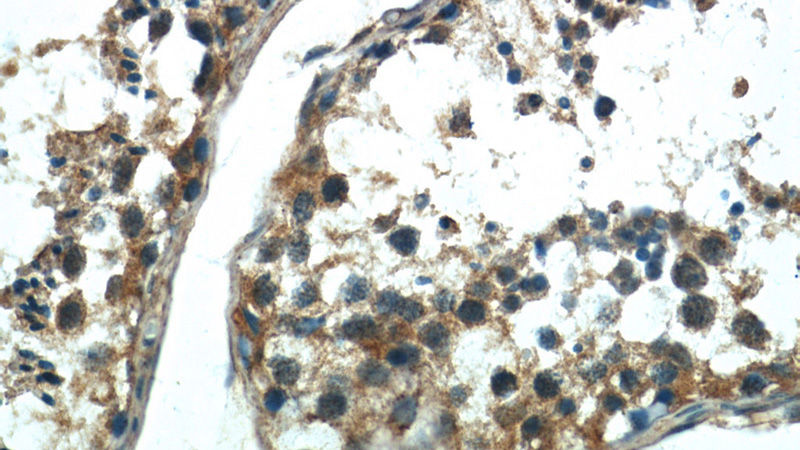 Immunohistochemistry of paraffin-embedded human testis tissue slide using Catalog No:115003(SCML2 Antibody) at dilution of 1:50 (under 40x lens)