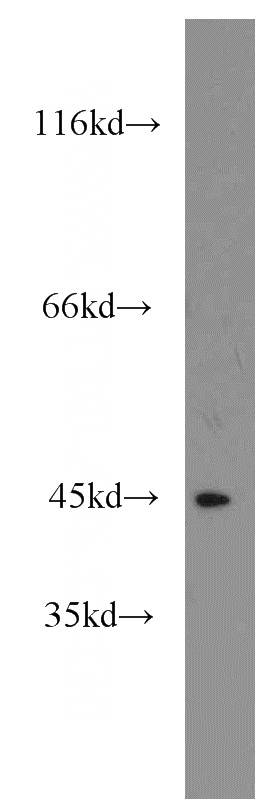 HepG2 cells were subjected to SDS PAGE followed by western blot with Catalog No:115718(STK32B antibody) at dilution of 1:500