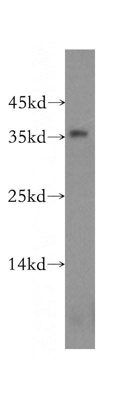 mouse kidney tissue were subjected to SDS PAGE followed by western blot with Catalog No:113217(NPL antibody) at dilution of 1:500
