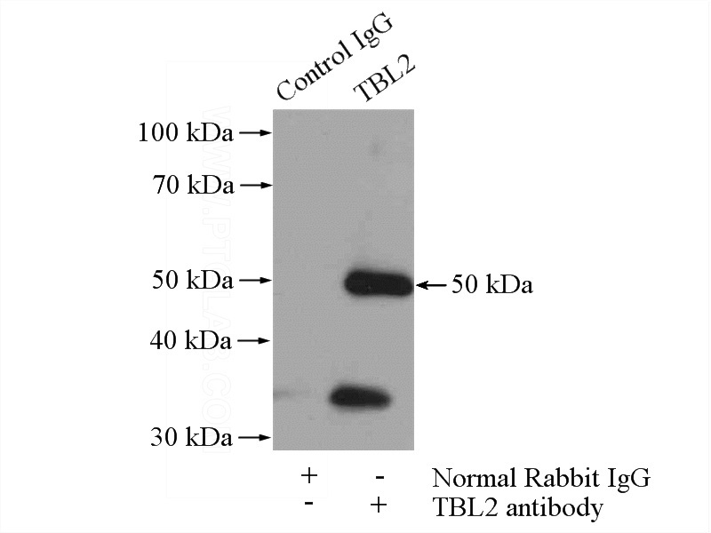 IP Result of anti-TBL2 (IP:Catalog No:115877, 4ug; Detection:Catalog No:115877 1:800) with COLO 320 cells lysate 2400ug.