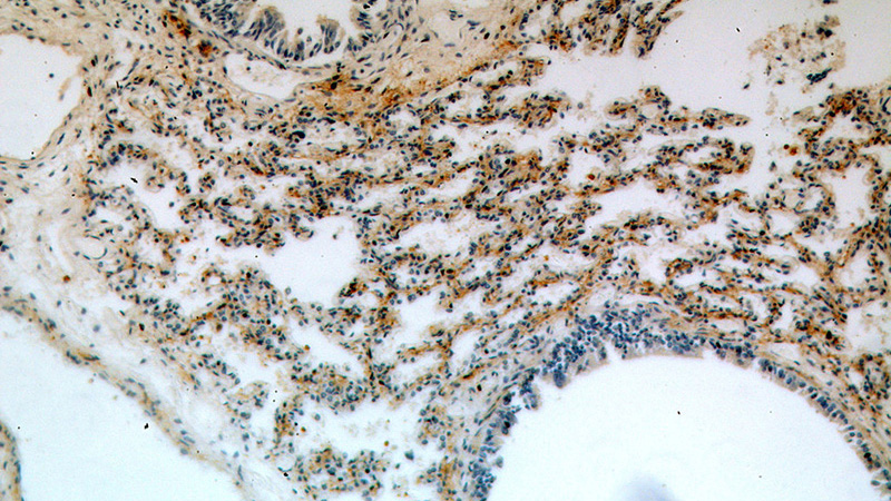 Immunohistochemical of paraffin-embedded human lung using Catalog No:113643(PDZD2 antibody) at dilution of 1:50 (under 10x lens)