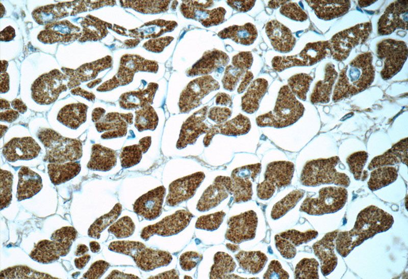 Immunohistochemistry of paraffin-embedded human heart tissue slide using Catalog No:112942(MYL2 Antibody) at dilution of 1:50 (under 40x lens)