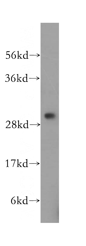 K-562 cells were subjected to SDS PAGE followed by western blot with Catalog No:109401(CLPP antibody) at dilution of 1:500