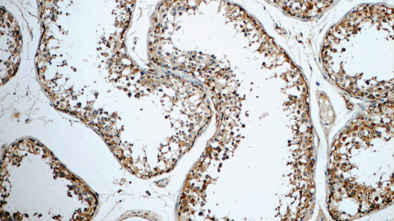 Immunohistochemistry of paraffin-embedded human testis tissue slide using Catalog No:116283(TMX3 Antibody) at dilution of 1:50 (under 10x lens)