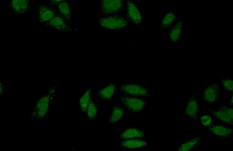 Immunofluorescent analysis of HepG2 cells using Catalog No:116946(ZNF124 Antibody) at dilution of 1:25 and Alexa Fluor 488-congugated AffiniPure Goat Anti-Rabbit IgG(H+L)